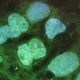 Stem cells seen on a computer screen at the University of Connecticut`s Stem Cell Institute